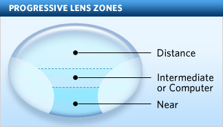 Progressive Lens Example